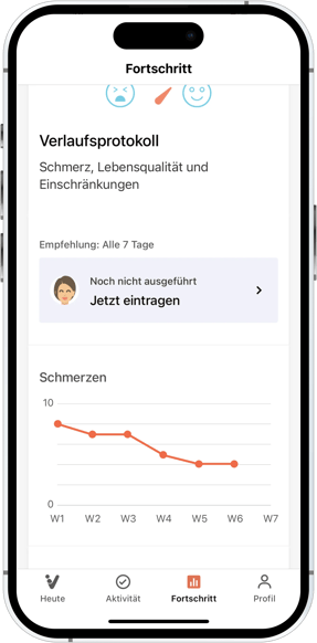 11.3_Progress___GRAPH_DE